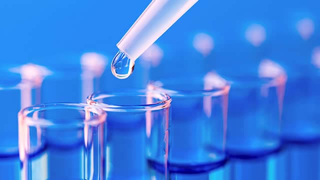 Radius Recycling (RDUS) Reports Q3 Loss, Beats Revenue Estimates