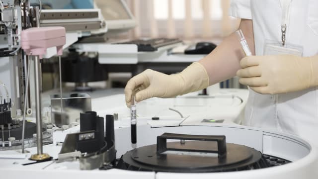 McKesson Corporation (MCK) is Attracting Investor Attention: Here is What You Should Know