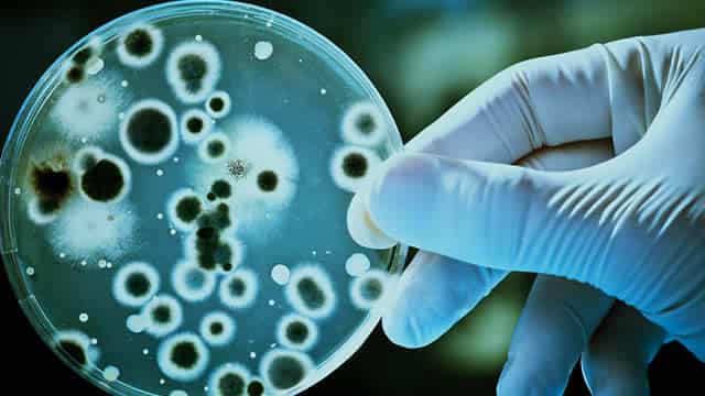 TG Therapeutics (TGTX) to Report Q1 Results: Wall Street Expects Earnings Growth
