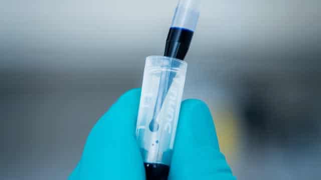 Novo Nordisk plans to start late-stage trials for experimental obesity drug amycretin