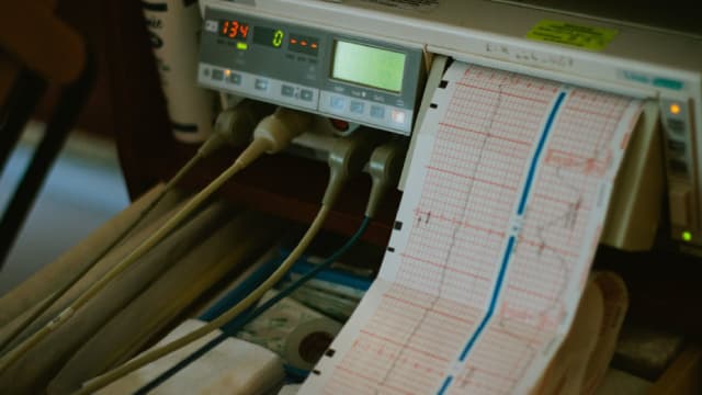 Countdown to Xylem (XYL) Q2 Earnings: A Look at Estimates Beyond Revenue and EPS