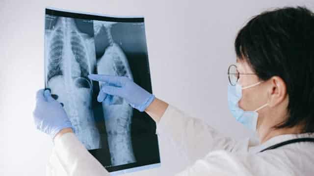 US FDA puts on hold Rein Therapeutics' lung disease drug trial