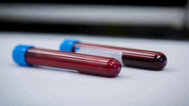 Growth Is Priced Out Of Novo Nordisk