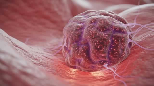 Cullinan Therapeutics Cancer Drug Shows Efficacy In Brain Metastases Among Lung Cancer Patients With Certain Mutations